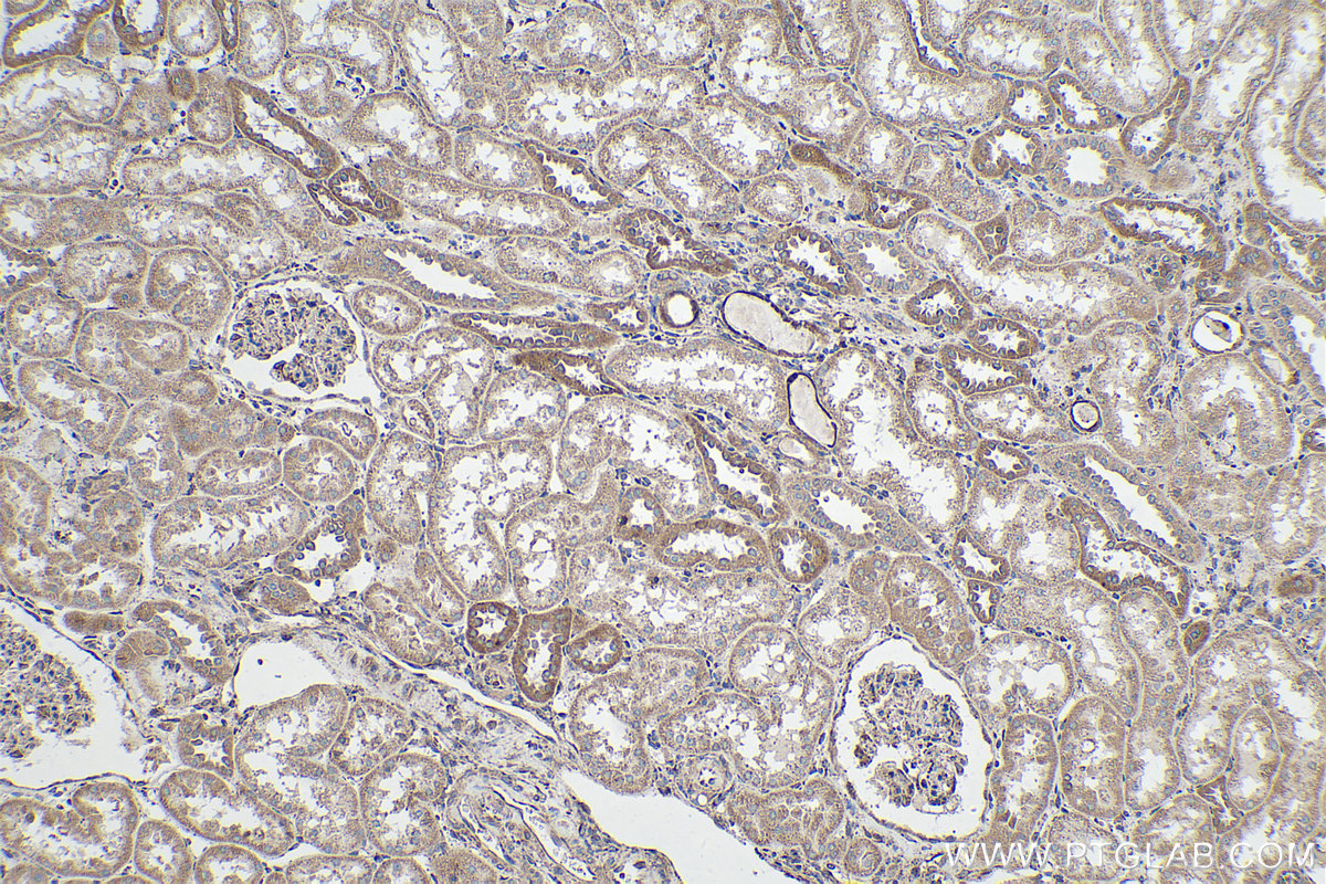 Immunohistochemical analysis of paraffin-embedded human kidney tissue slide using KHC0221 (Integrin Beta 6 IHC Kit).