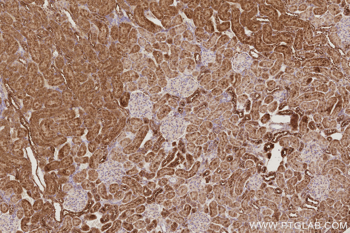 Immunohistochemical analysis of paraffin-embedded rat kidney tissue slide using KHC3096 (IVNS1ABP IHC Kit). Immunohistochemical analysis of paraffin-embedded rat kidney tissue slide using KHC3096 (IVNS1ABP IHC Kit).