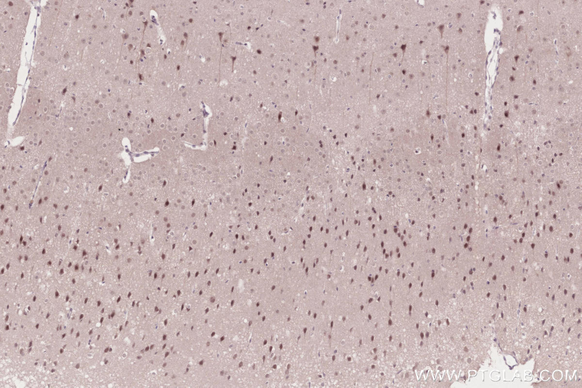 Immunohistochemical analysis of paraffin-embedded mouse brain tissue slide using KHC2672 (JMJD5 IHC Kit).