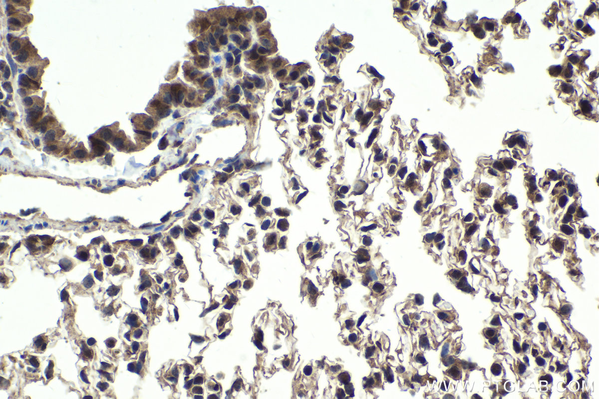 Immunohistochemical analysis of paraffin-embedded mouse lung tissue slide using KHC1788 (JMJD6 IHC Kit).