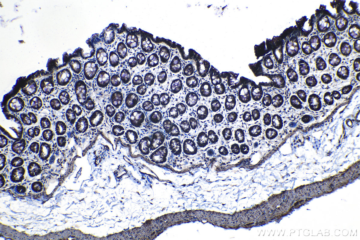 Immunohistochemical analysis of paraffin-embedded rat colon tissue slide using KHC1267 (JMY IHC Kit).