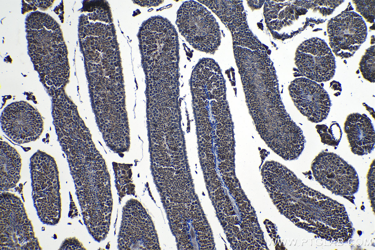 Immunohistochemical analysis of paraffin-embedded mouse testis tissue slide using KHC1267 (JMY IHC Kit).