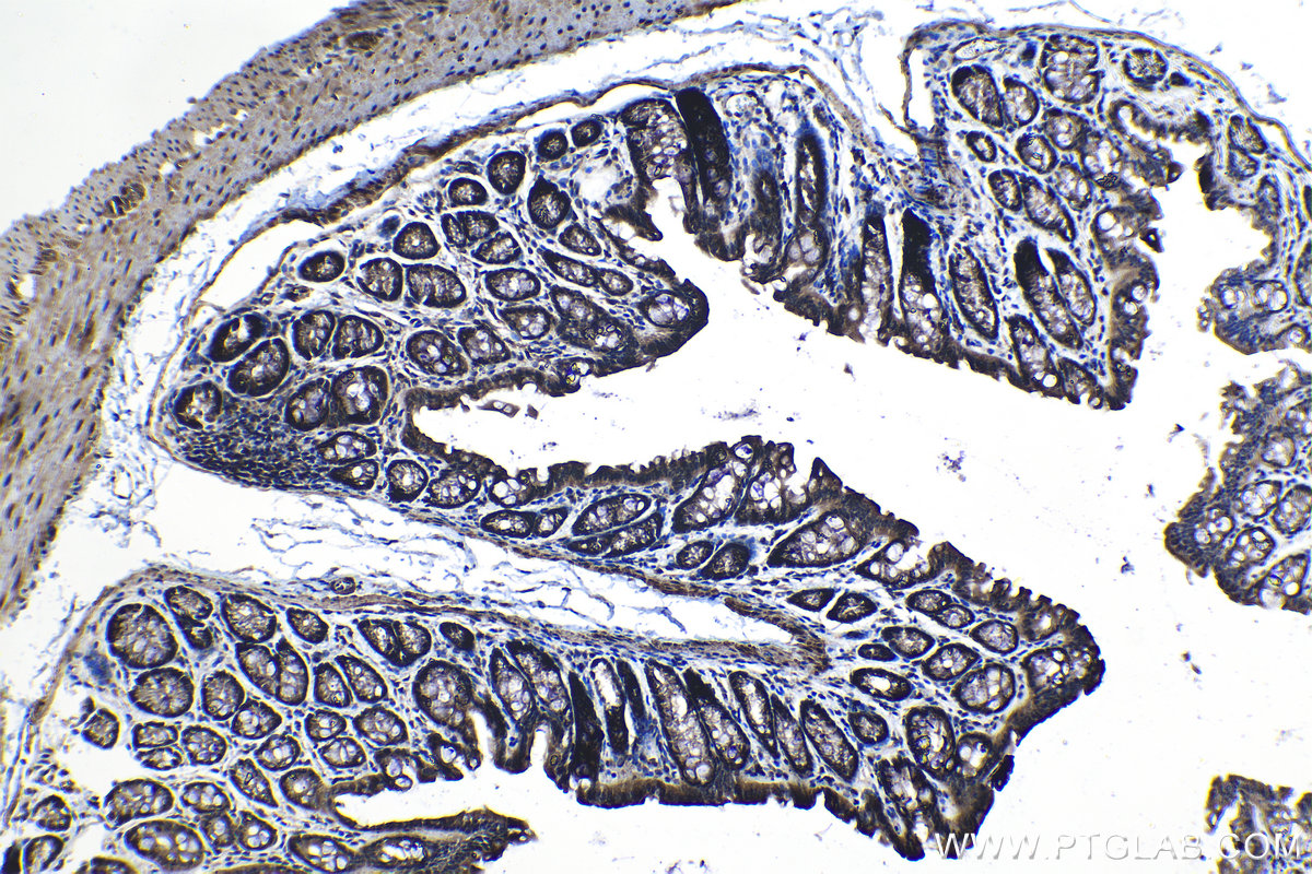 Immunohistochemical analysis of paraffin-embedded mouse colon tissue slide using KHC1267 (JMY IHC Kit).