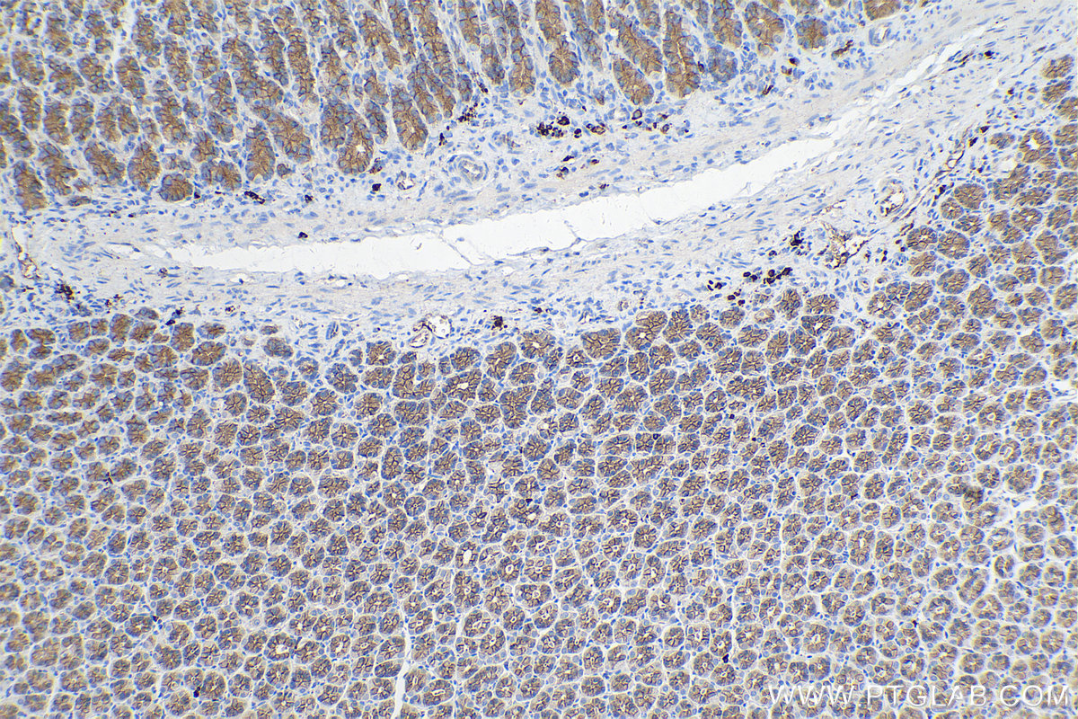 Immunohistochemical analysis of paraffin-embedded rat stomach tissue slide using KHC0263 ( JUP IHC Kit).