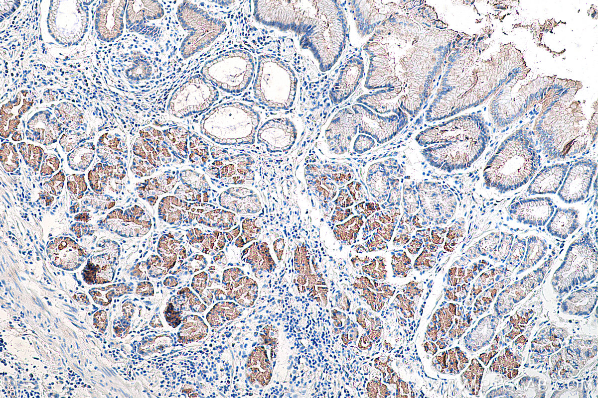 Immunohistochemical analysis of paraffin-embedded human stomach cancer(NAT) tissue slide using KHC0263 ( JUP IHC Kit).