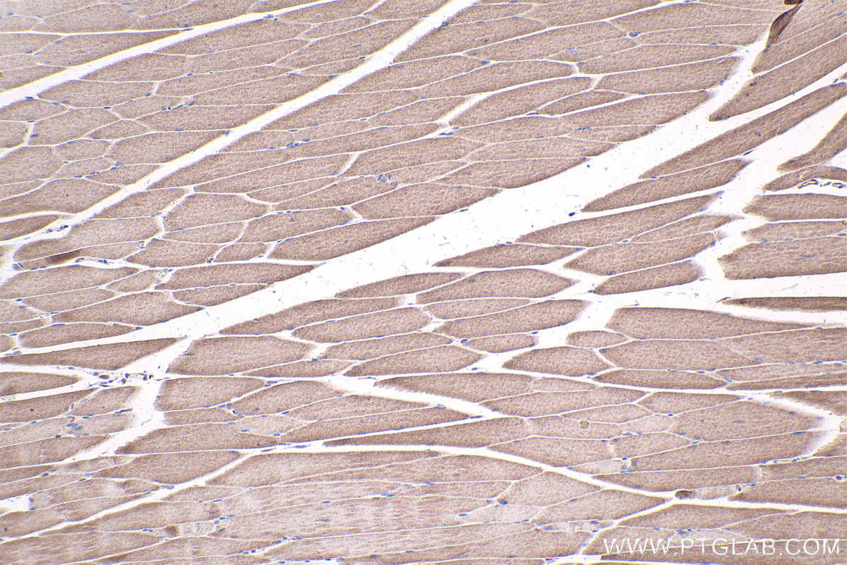 Immunohistochemical analysis of paraffin-embedded mouse skeletal muscle tissue slide using KHC1734 (KANK1 IHC Kit).