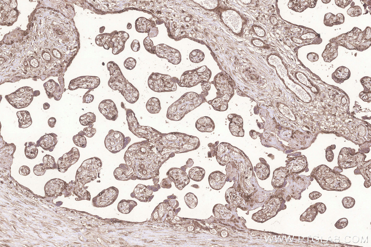 Immunohistochemical analysis of paraffin-embedded human placenta tissue slide using KHC3255 (KARS IHC Kit).