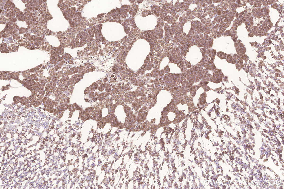 Immunohistochemical analysis of paraffin-embedded rat adrenal gland tissue slide using KHC3255 (KARS IHC Kit).