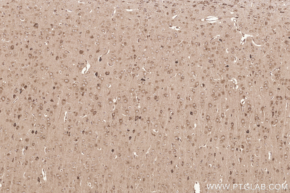 Immunohistochemical analysis of paraffin-embedded rat brain tissue slide using KHC3255 (KARS IHC Kit).