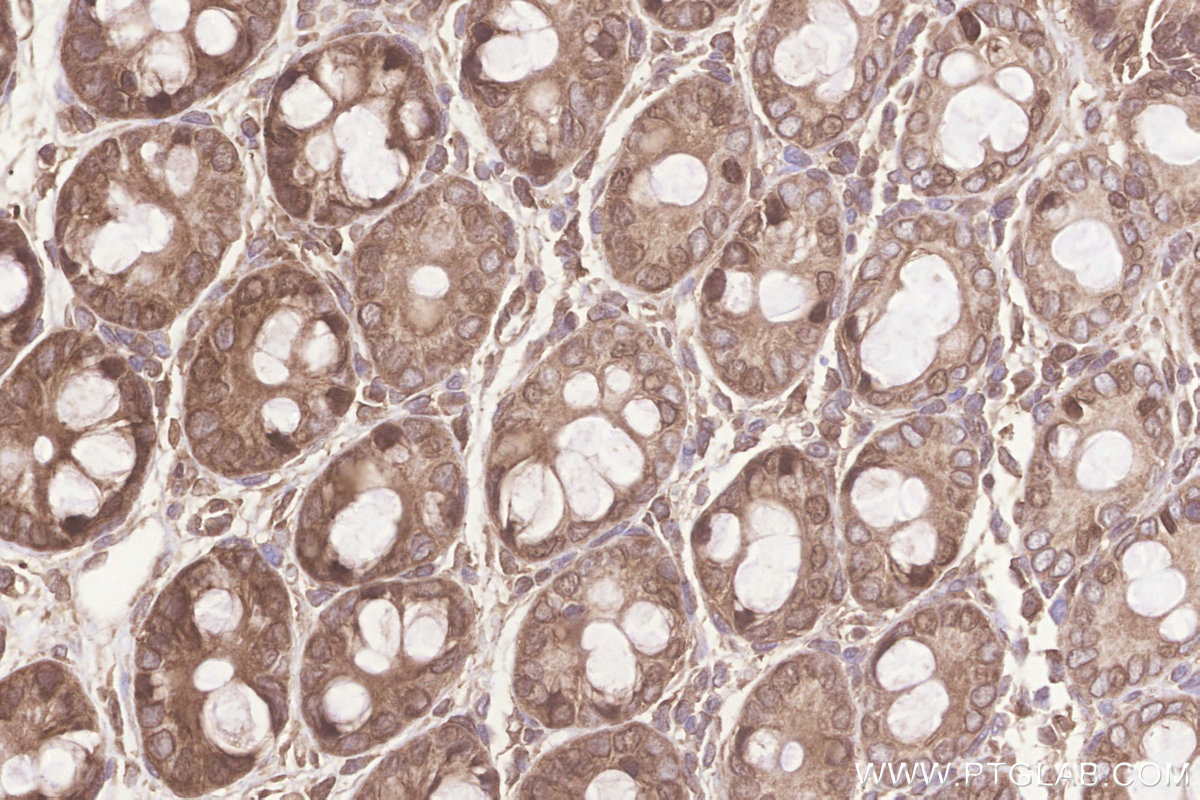 Immunohistochemical analysis of paraffin-embedded rat colon tissue slide using KHC3255 (KARS IHC Kit).