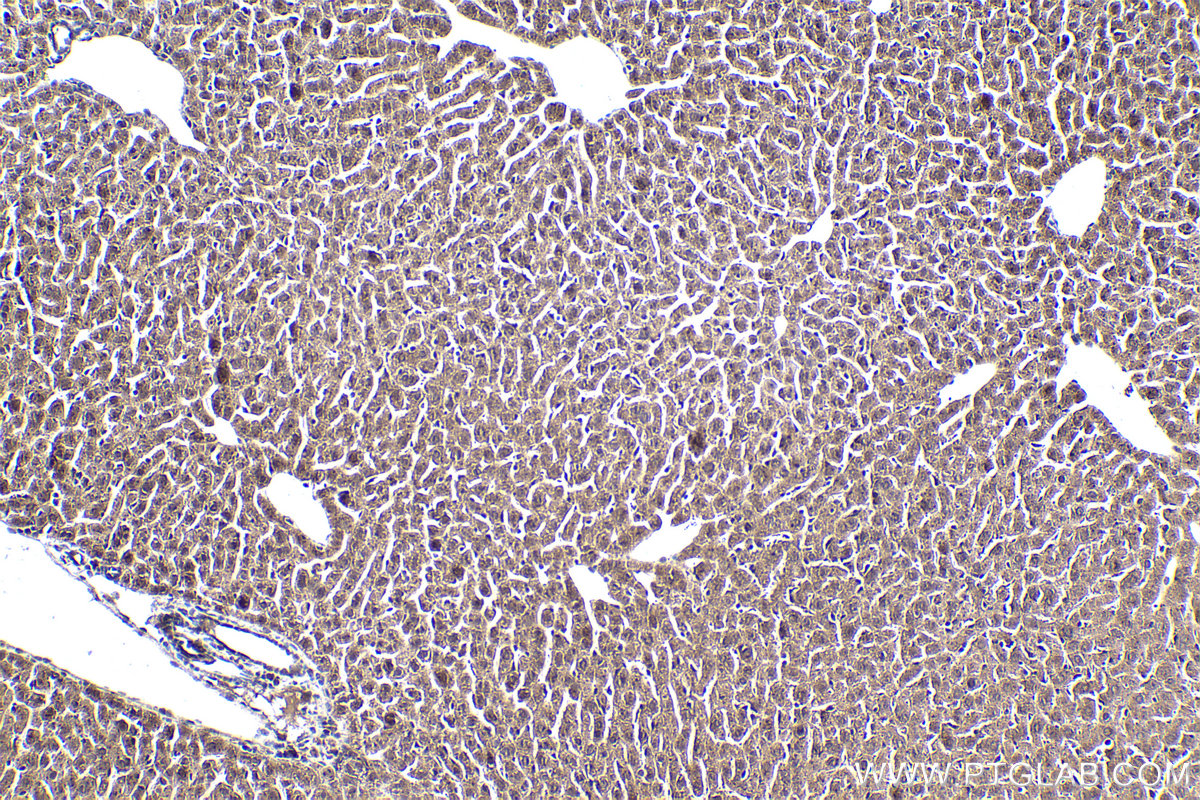 Immunohistochemical analysis of paraffin-embedded mouse liver tissue slide using KHC1862 (KAT5 IHC Kit).