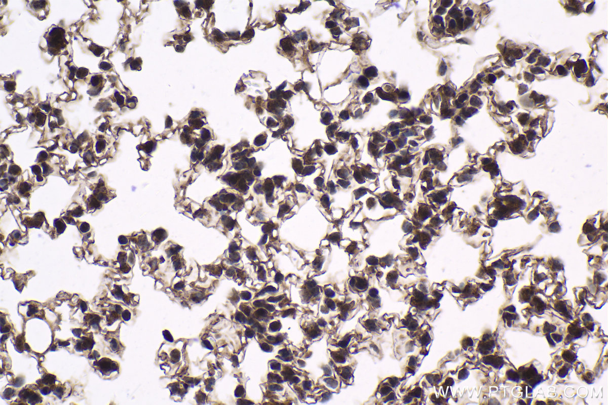 Immunohistochemical analysis of paraffin-embedded mouse lung tissue slide using KHC1862 (KAT5 IHC Kit).