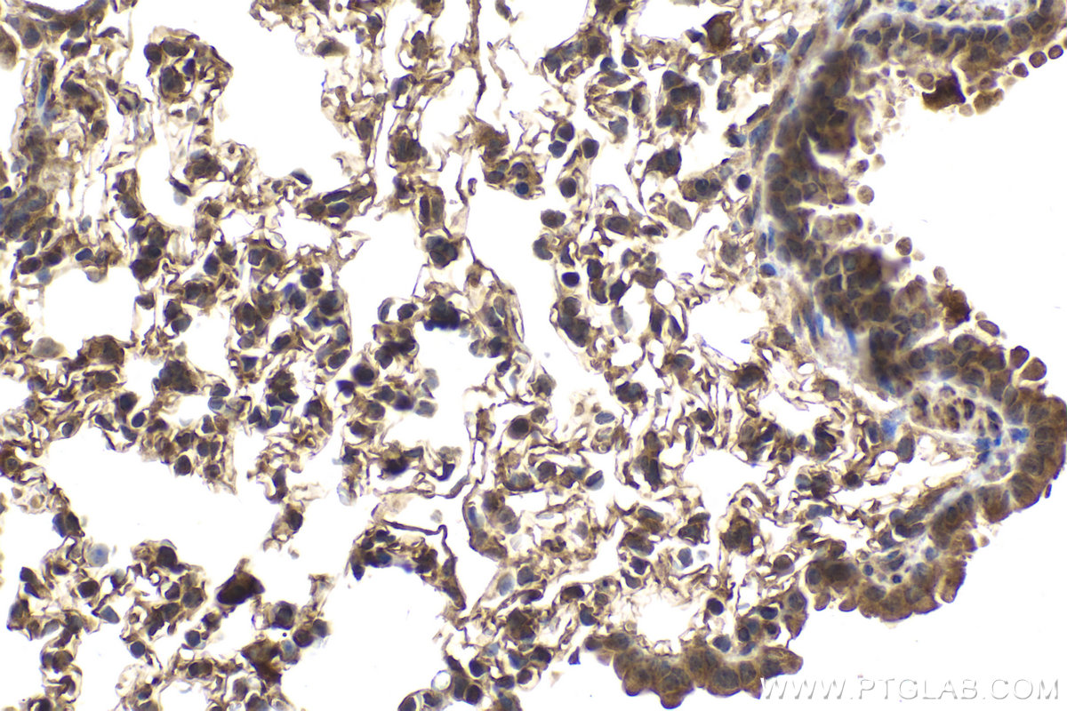 Immunohistochemical analysis of paraffin-embedded mouse lung tissue slide using KHC2113 (KATNA1 IHC Kit).