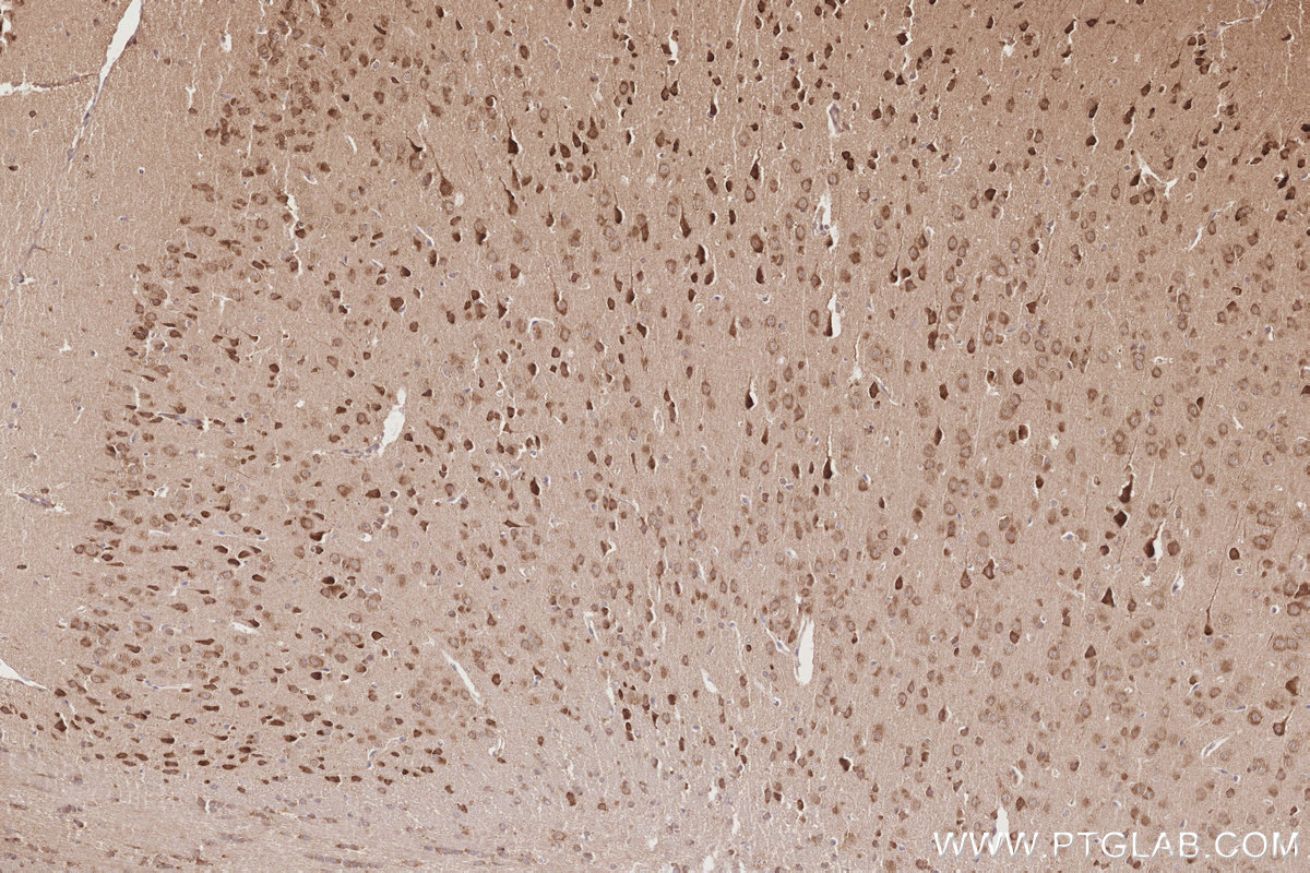 Immunohistochemical analysis of paraffin-embedded mouse brain tissue slide using KHC2873 (KATNB1 IHC Kit).