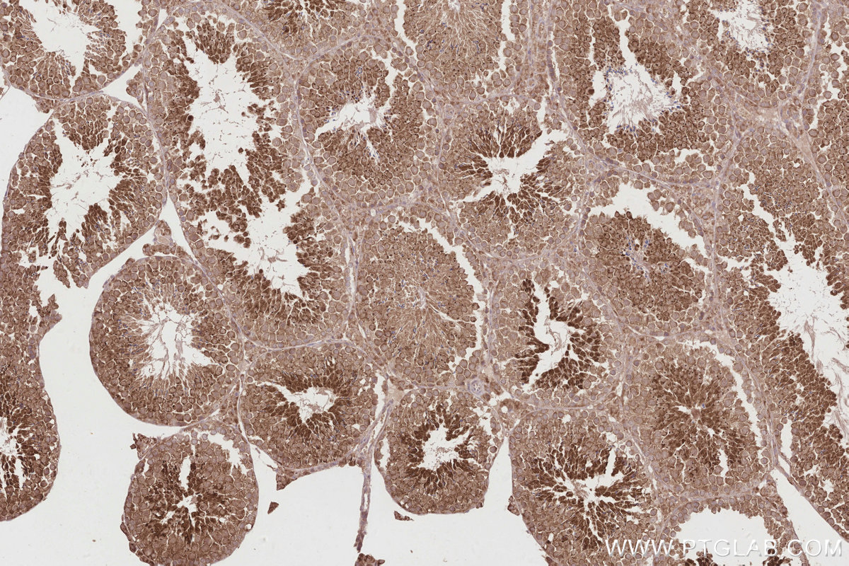 Immunohistochemical analysis of paraffin-embedded mouse testis tissue slide using KHC2873 (KATNB1 IHC Kit).
