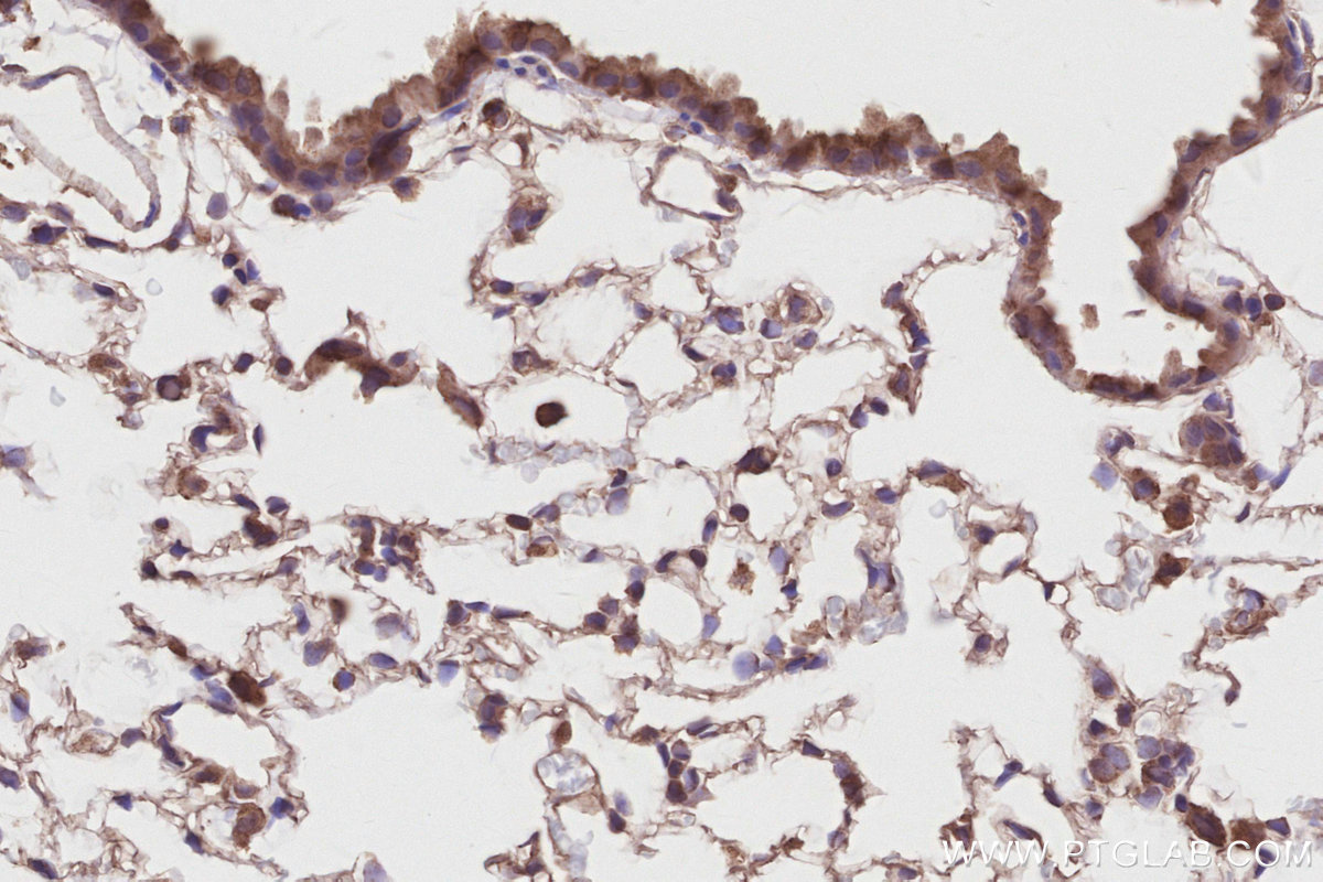 Immunohistochemical analysis of paraffin-embedded mouse lung tissue slide using KHC2873 (KATNB1 IHC Kit).