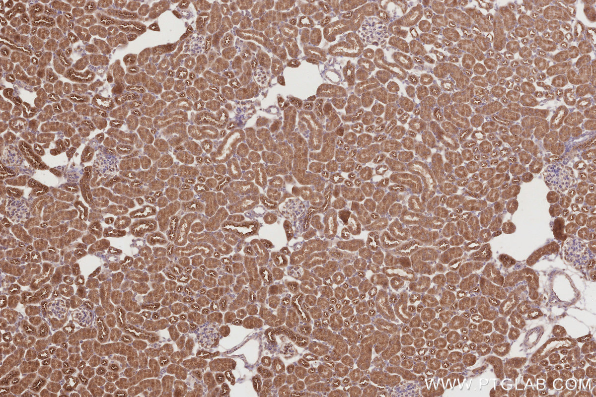 Immunohistochemical analysis of paraffin-embedded mouse kidney tissue slide using KHC2873 (KATNB1 IHC Kit).