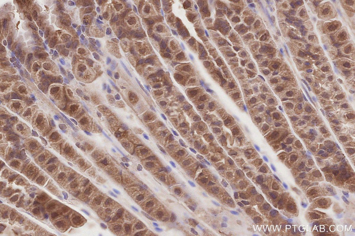 Immunohistochemical analysis of paraffin-embedded mouse stomach tissue slide using KHC2873 (KATNB1 IHC Kit).