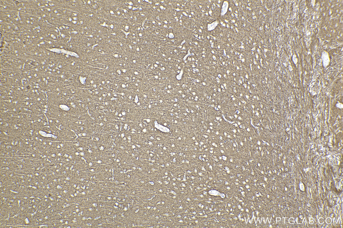 Immunohistochemical analysis of paraffin-embedded rat brain tissue slide using KHC2192 (KCNA2 IHC Kit).