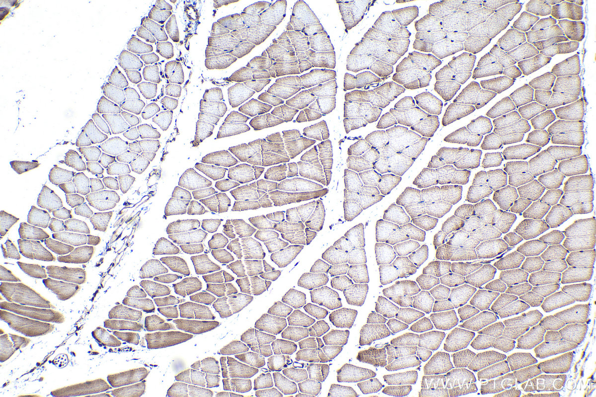 Immunohistochemical analysis of paraffin-embedded mouse skeletal muscle tissue slide using KHC1064 (KEAP1 IHC Kit).