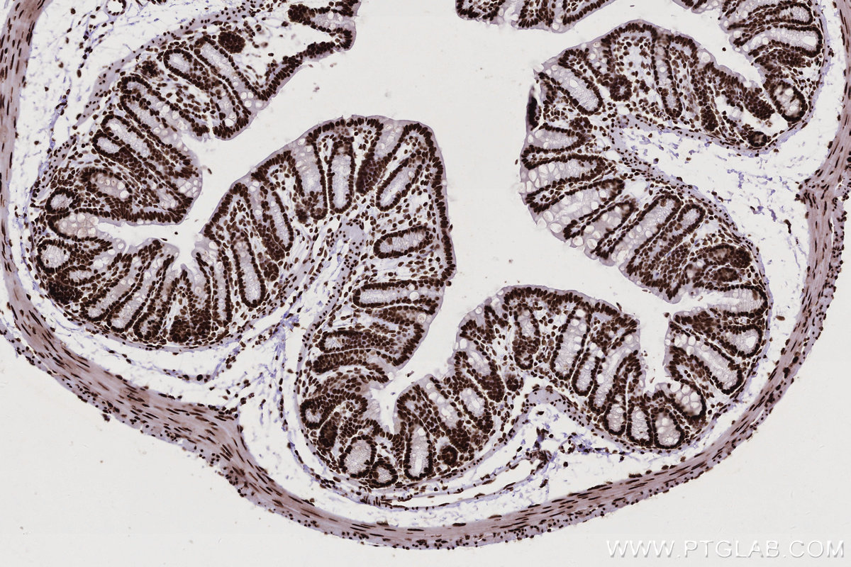 Immunohistochemical analysis of paraffin-embedded mouse colon tissue slide using KHC2767 (KHSRP IHC Kit).