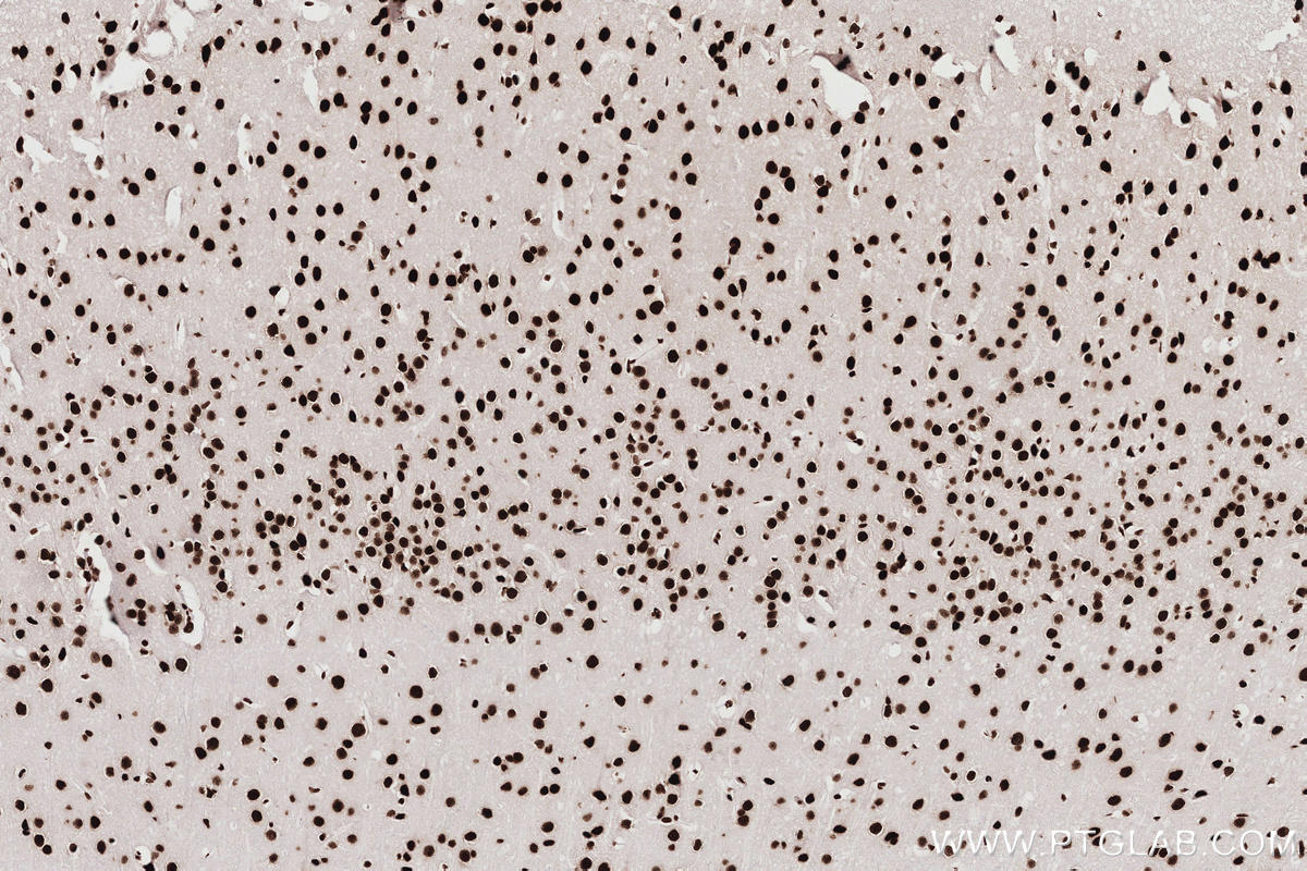 Immunohistochemical analysis of paraffin-embedded mouse brain tissue slide using KHC2767 (KHSRP IHC Kit).