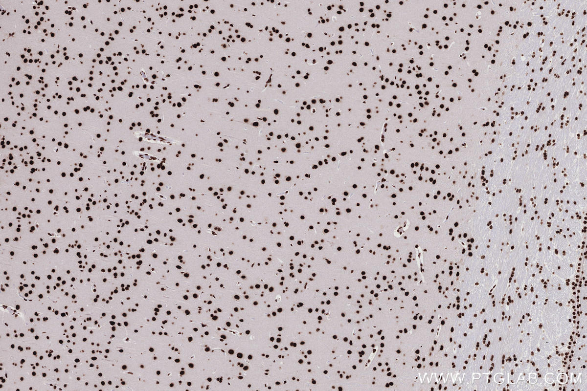 Immunohistochemical analysis of paraffin-embedded rat brain tissue slide using KHC2767 (KHSRP IHC Kit).