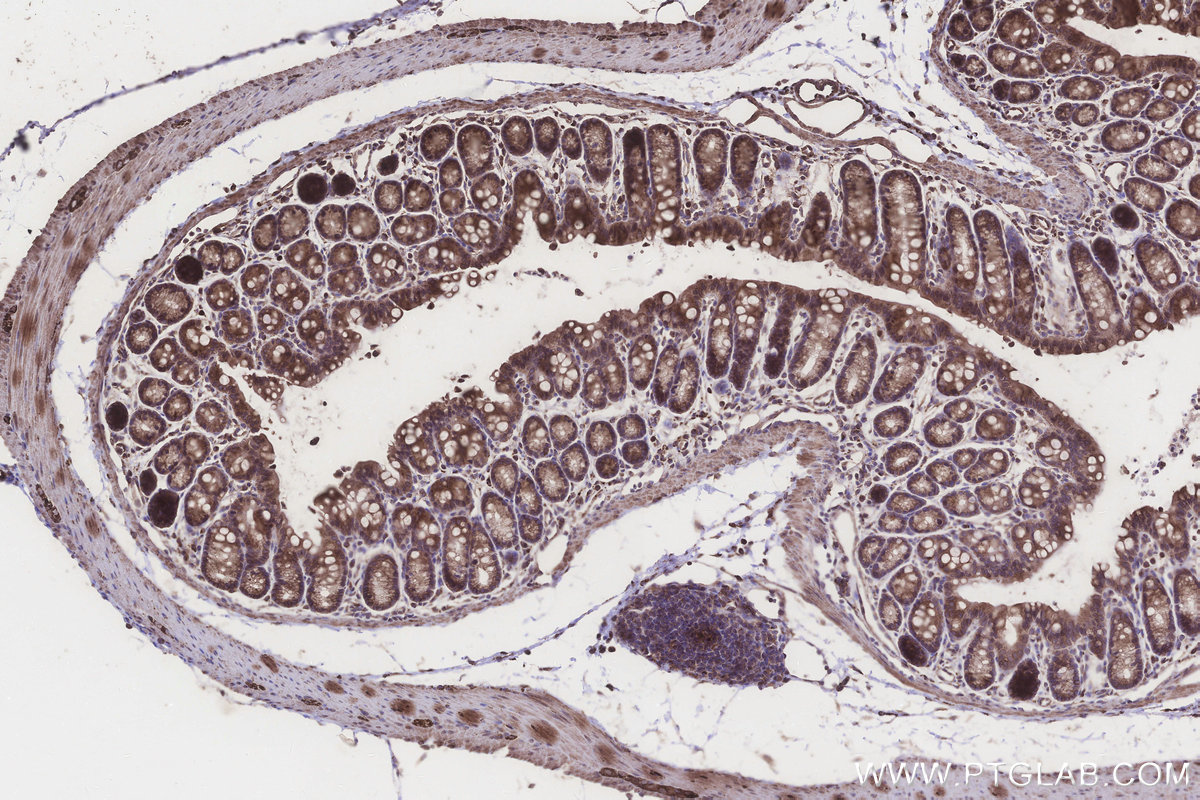 Immunohistochemical analysis of paraffin-embedded mouse colon tissue slide using KHC3290 (KIAA0090 IHC Kit).