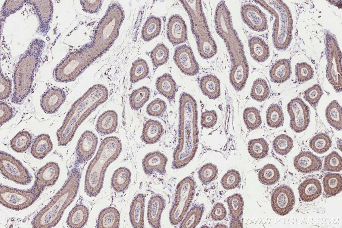 Immunohistochemical analysis of paraffin-embedded mouse epididymis tissue slide using KHC3290 (KIAA0090 IHC Kit).