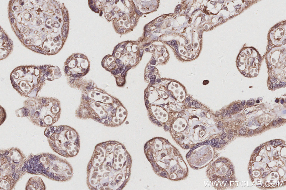 Immunohistochemical analysis of paraffin-embedded human placenta tissue slide using KHC3036 (KIDINS220 IHC Kit). Immunohistochemical analysis of paraffin-embedded human placenta tissue slide using KHC3036 (KIDINS220 IHC Kit).
