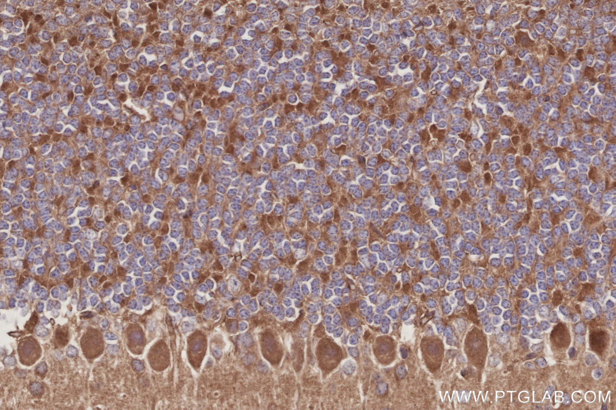 Immunohistochemical analysis of paraffin-embedded mouse cerebellum tissue slide using KHC3036 (KIDINS220 IHC Kit). Immunohistochemical analysis of paraffin-embedded mouse cerebellum tissue slide using KHC3036 (KIDINS220 IHC Kit).