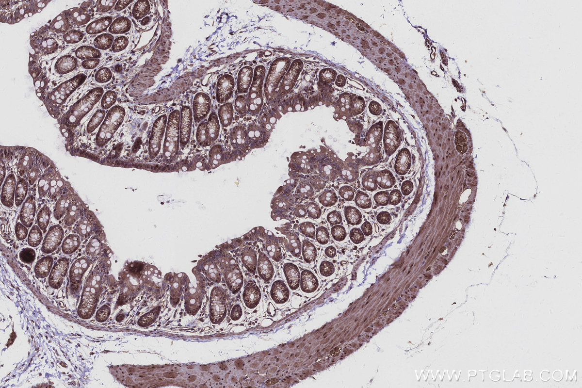 Immunohistochemical analysis of paraffin-embedded mouse colon tissue slide using KHC2951 (KIF15 IHC Kit).