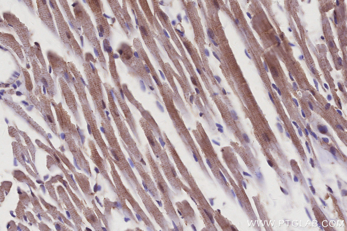 Immunohistochemical analysis of paraffin-embedded mouse heart tissue slide using KHC2951 (KIF15 IHC Kit).