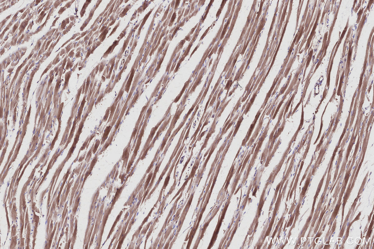 Immunohistochemical analysis of paraffin-embedded rat heart tissue slide using KHC2951 (KIF15 IHC Kit).