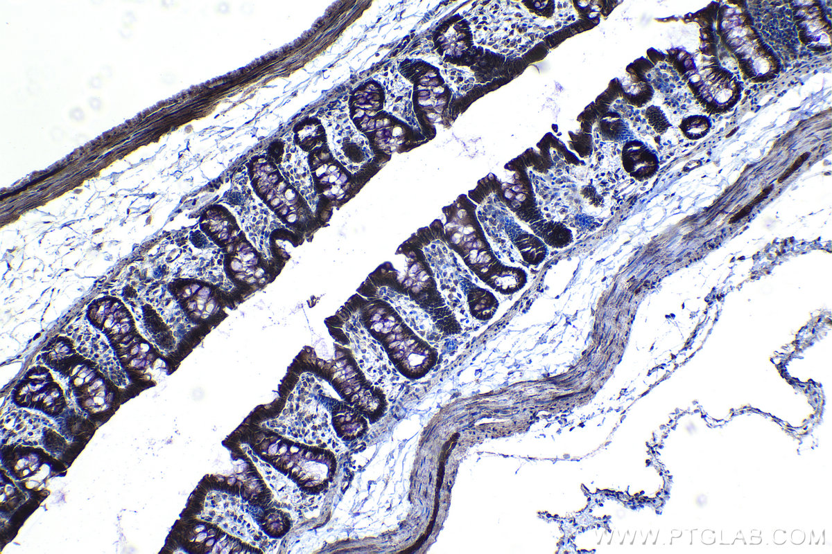 Immunohistochemical analysis of paraffin-embedded rat colon tissue slide using KHC1223 (KIF18A IHC Kit).