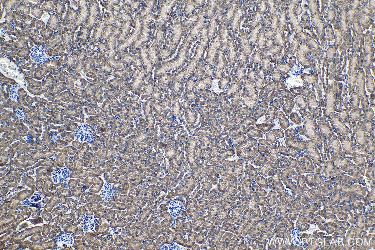 Immunohistochemical analysis of paraffin-embedded mouse kidney tissue slide using KHC1223 (KIF18A IHC Kit).