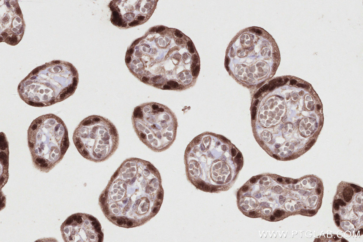 Immunohistochemical analysis of paraffin-embedded human placenta tissue slide using KHC2820 (KIF20B IHC Kit).