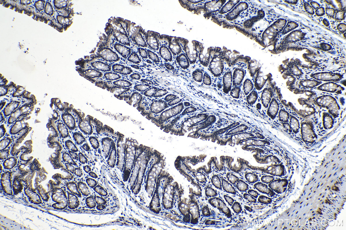 Immunohistochemical analysis of paraffin-embedded mouse colon tissue slide using KHC1255 (KIF22 IHC Kit).