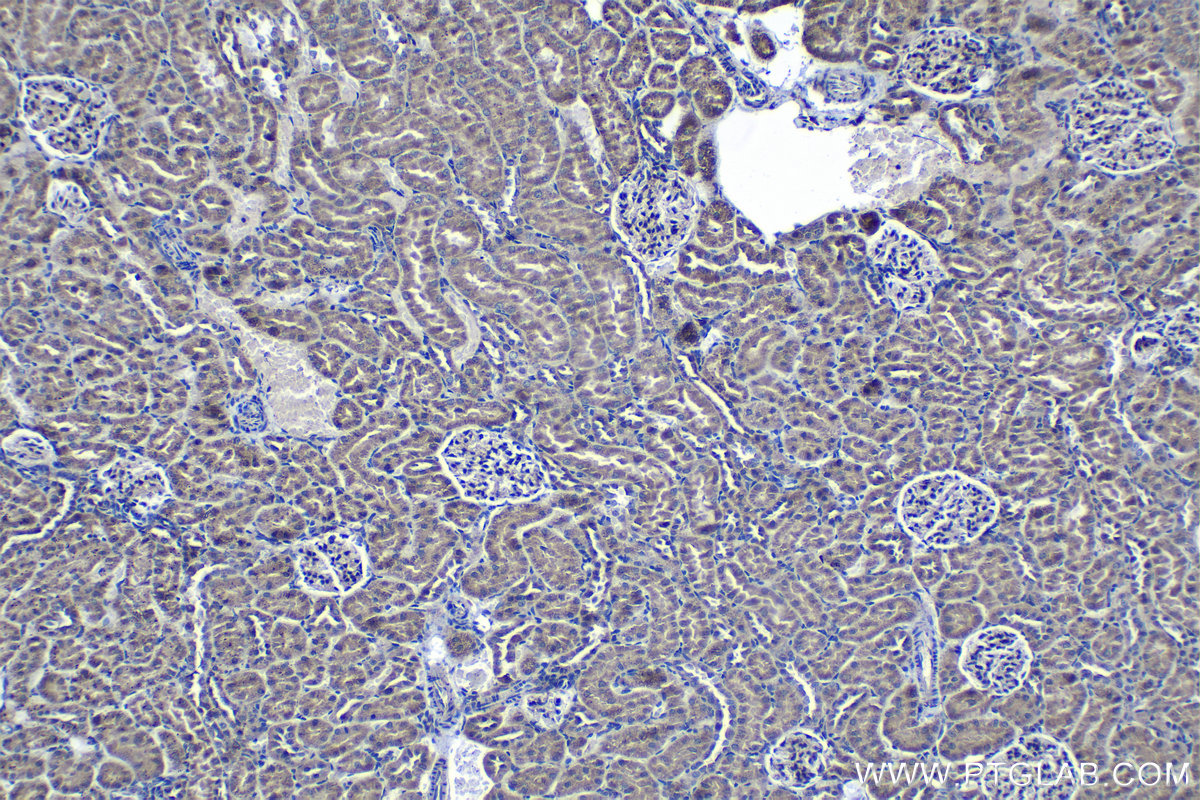 Immunohistochemical analysis of paraffin-embedded rat kidney tissue slide using KHC1268 (KIF26B IHC Kit).