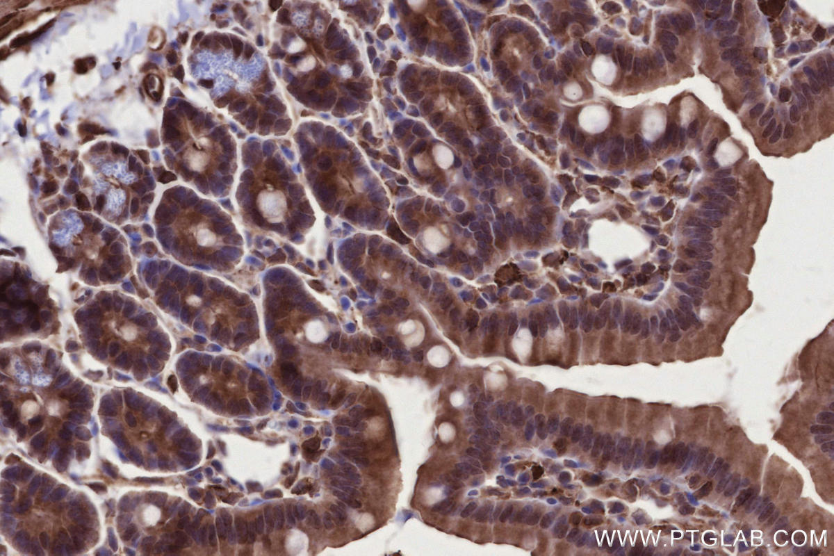 Immunohistochemical analysis of paraffin-embedded mouse small intestine tissue slide using KHC2674 (KIF2B IHC Kit).
