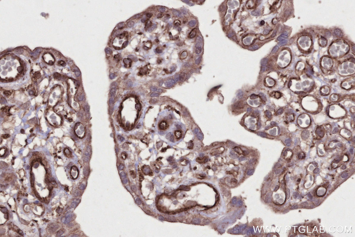 Immunohistochemical analysis of paraffin-embedded human placenta tissue slide using KHC2674 (KIF2B IHC Kit).