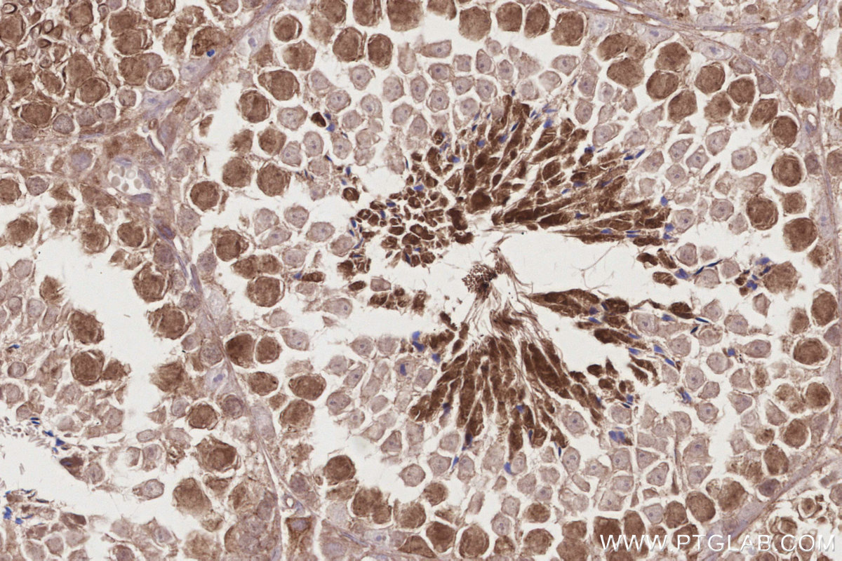 Immunohistochemical analysis of paraffin-embedded mouse testis tissue slide using KHC2845 (KIF2C IHC Kit).