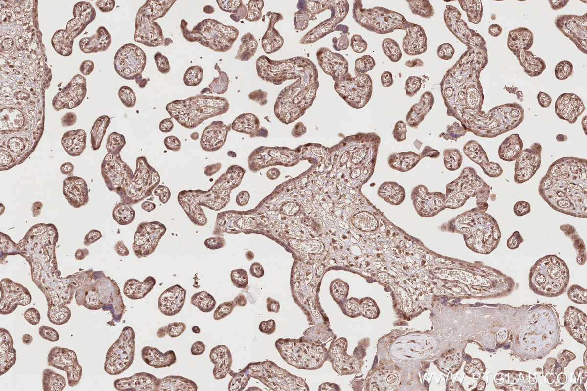 Immunohistochemical analysis of paraffin-embedded human placenta tissue slide using KHC2845 (KIF2C IHC Kit).