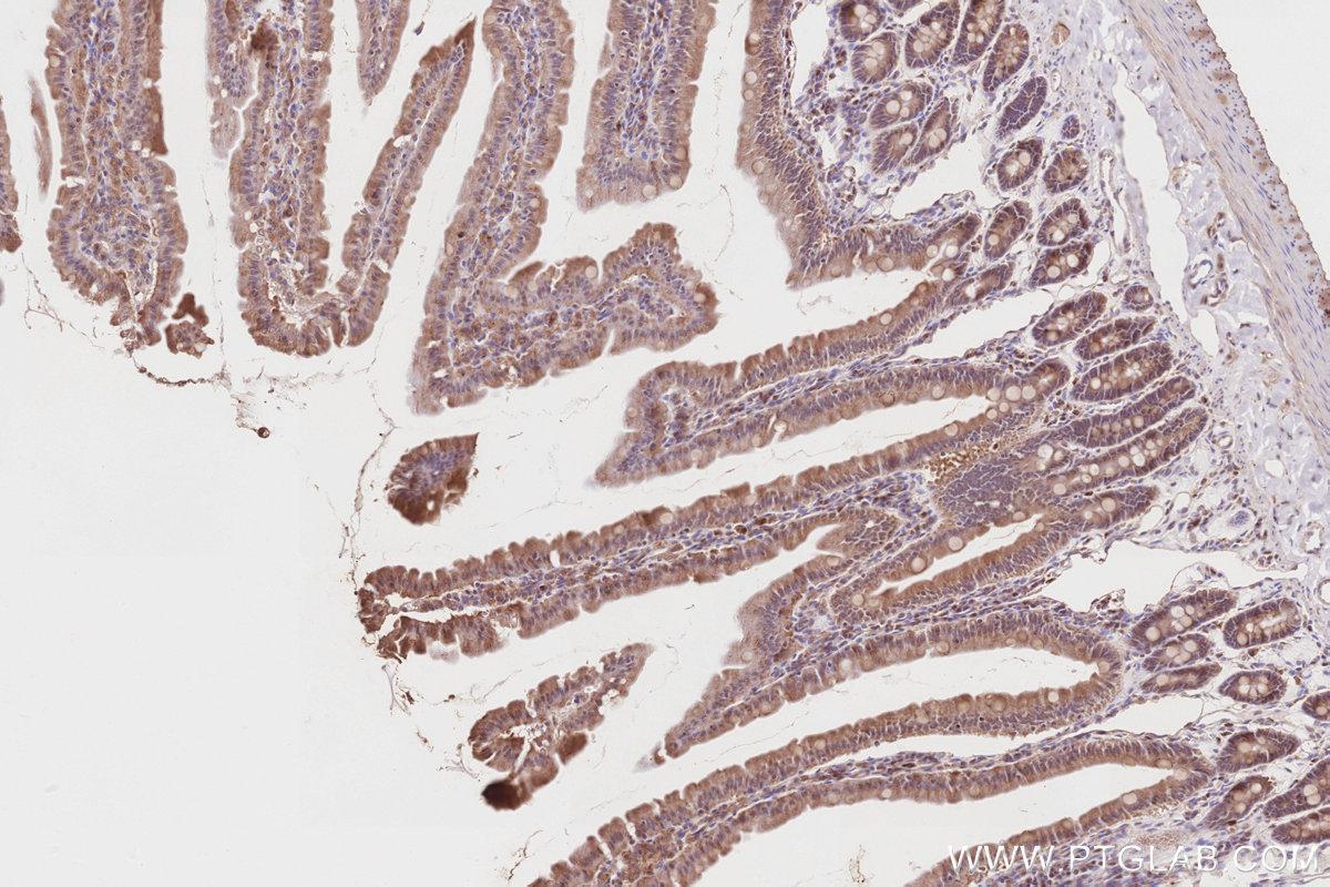 Immunohistochemical analysis of paraffin-embedded rat small intestine tissue slide using KHC2845 (KIF2C IHC Kit).