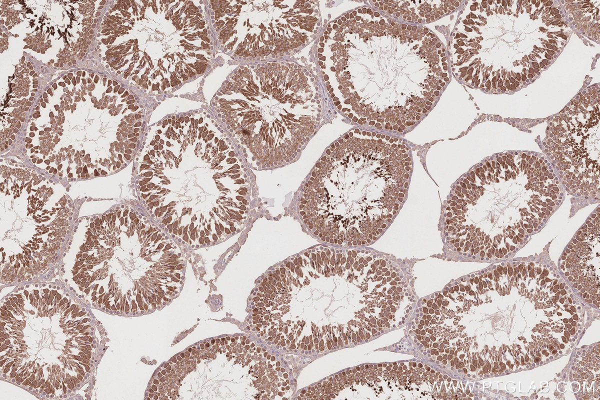 Immunohistochemical analysis of paraffin-embedded rat testis tissue slide using KHC2845 (KIF2C IHC Kit).