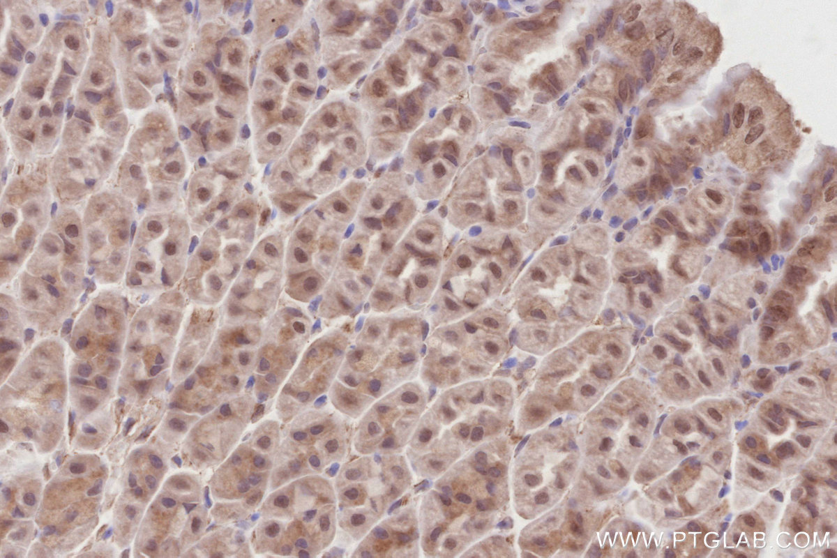 Immunohistochemical analysis of paraffin-embedded mouse stomach tissue slide using KHC2876 (KIFC1 IHC Kit).