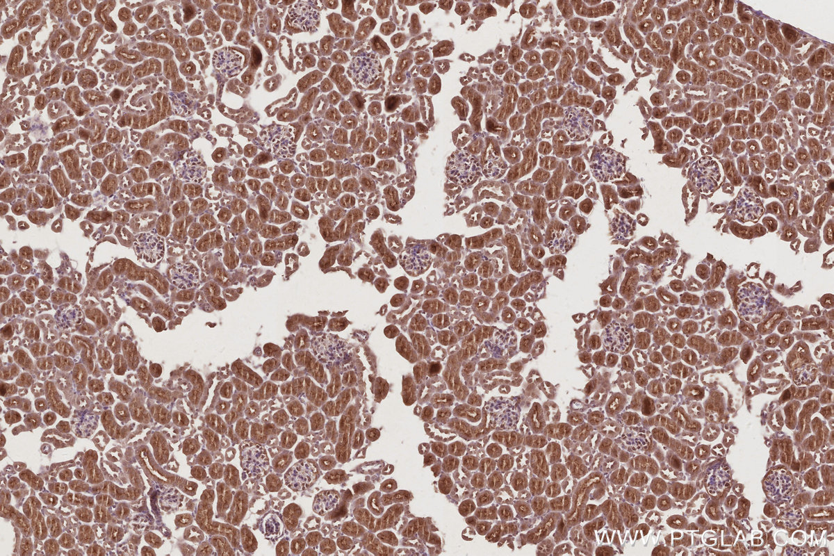 Immunohistochemical analysis of paraffin-embedded mouse kidney tissue slide using KHC2876 (KIFC1 IHC Kit).