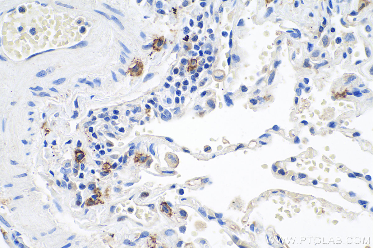 Immunohistochemical analysis of paraffin-embedded human lung tissue slide using KHC0818 (KIT/CD117 IHC Kit).