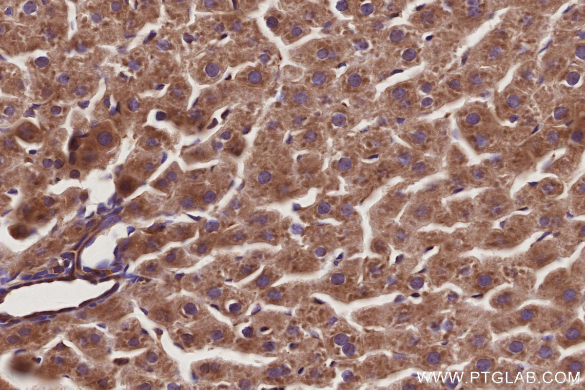 Immunohistochemical analysis of paraffin-embedded rat liver tissue slide using KHC2953 (KLC4 IHC Kit).