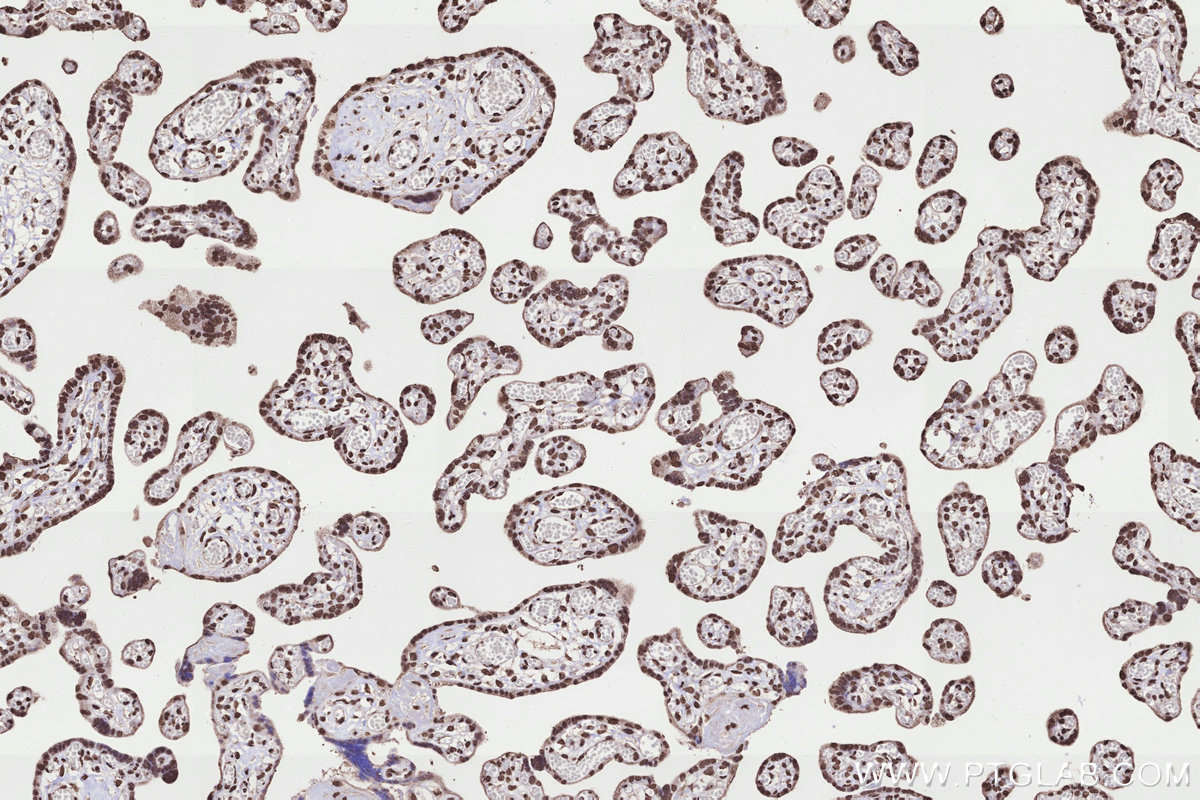 Immunohistochemical analysis of paraffin-embedded human placenta tissue slide using KHC3298 (KMT2C IHC Kit).